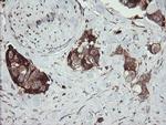 TPD52L3 Antibody in Immunohistochemistry (Paraffin) (IHC (P))