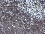 TPD52L3 Antibody in Immunohistochemistry (Paraffin) (IHC (P))