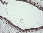 TPD52L3 Antibody in Immunohistochemistry (Paraffin) (IHC (P))