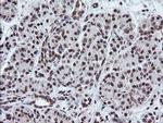 TPD52L3 Antibody in Immunohistochemistry (Paraffin) (IHC (P))