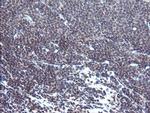 TPD52L3 Antibody in Immunohistochemistry (Paraffin) (IHC (P))