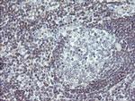 TPD52L3 Antibody in Immunohistochemistry (Paraffin) (IHC (P))
