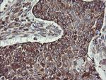 TPD52L3 Antibody in Immunohistochemistry (Paraffin) (IHC (P))