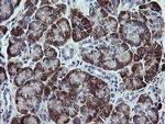 TPD52L3 Antibody in Immunohistochemistry (Paraffin) (IHC (P))