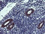 TPD52L3 Antibody in Immunohistochemistry (Paraffin) (IHC (P))