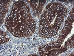 TPD52L3 Antibody in Immunohistochemistry (Paraffin) (IHC (P))
