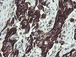 TPD52L3 Antibody in Immunohistochemistry (Paraffin) (IHC (P))