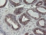 TPD52L3 Antibody in Immunohistochemistry (Paraffin) (IHC (P))