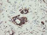 TPD52L3 Antibody in Immunohistochemistry (Paraffin) (IHC (P))