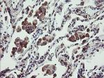 TPD52L3 Antibody in Immunohistochemistry (Paraffin) (IHC (P))