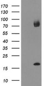 TPD52L3 Antibody in Western Blot (WB)