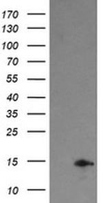 TPD52L3 Antibody in Western Blot (WB)