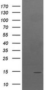 TPD52L3 Antibody in Western Blot (WB)