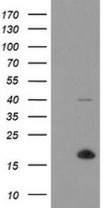 TPD52L3 Antibody in Western Blot (WB)