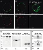 GFP Antibody in Immunocytochemistry (ICC/IF)
