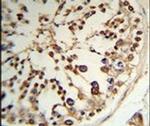 TPK1 Antibody in Immunohistochemistry (IHC)