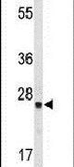 TPK1 Antibody in Western Blot (WB)