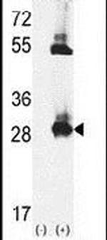 TPK1 Antibody in Western Blot (WB)