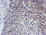 TPRKB Antibody in Immunohistochemistry (Paraffin) (IHC (P))