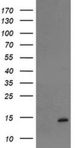 TPRKB Antibody in Western Blot (WB)