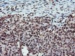 TPSG1 Antibody in Immunohistochemistry (Paraffin) (IHC (P))