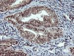 TPSG1 Antibody in Immunohistochemistry (Paraffin) (IHC (P))