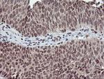 TPSG1 Antibody in Immunohistochemistry (Paraffin) (IHC (P))