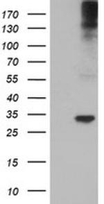 TPSG1 Antibody in Western Blot (WB)