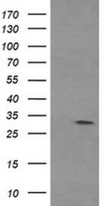 TPSG1 Antibody in Western Blot (WB)