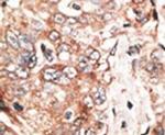 TPX2 Antibody in Immunohistochemistry (IHC)