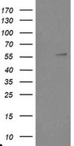 TRAIP Antibody in Western Blot (WB)