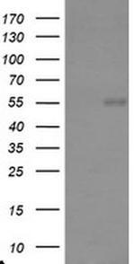 TRAIP Antibody in Western Blot (WB)
