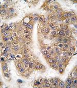 TRIP Antibody in Immunohistochemistry (IHC)