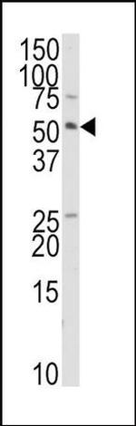 TRIP Antibody in Western Blot (WB)