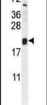 TRAPPC3 Antibody in Western Blot (WB)