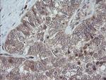 TRAPPC4 Antibody in Immunohistochemistry (Paraffin) (IHC (P))