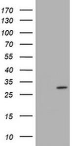 TRAPPC4 Antibody in Western Blot (WB)
