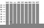 TRAPPC4 Antibody in Western Blot (WB)