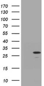 TRAPPC4 Antibody in Western Blot (WB)