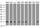 TRAPPC4 Antibody in Western Blot (WB)