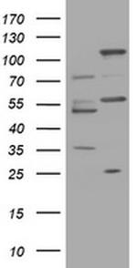 TRAPPC4 Antibody in Western Blot (WB)