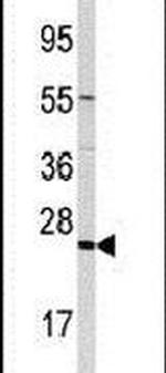 TRAPPC4 Antibody in Western Blot (WB)