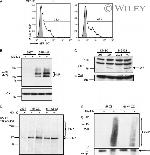 Calreticulin Antibody in Western Blot (WB)