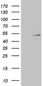 TRDMT1 Antibody in Western Blot (WB)
