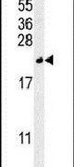 TREM2 Antibody in Western Blot (WB)