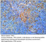 TRF2 Polyclonal Antibody