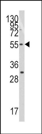 TRF1 Antibody in Western Blot (WB)
