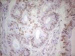 TRIB1 Antibody in Immunohistochemistry (Paraffin) (IHC (P))