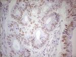 TRIB1 Antibody in Immunohistochemistry (Paraffin) (IHC (P))