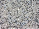 TRIB2 Antibody in Immunohistochemistry (Paraffin) (IHC (P))